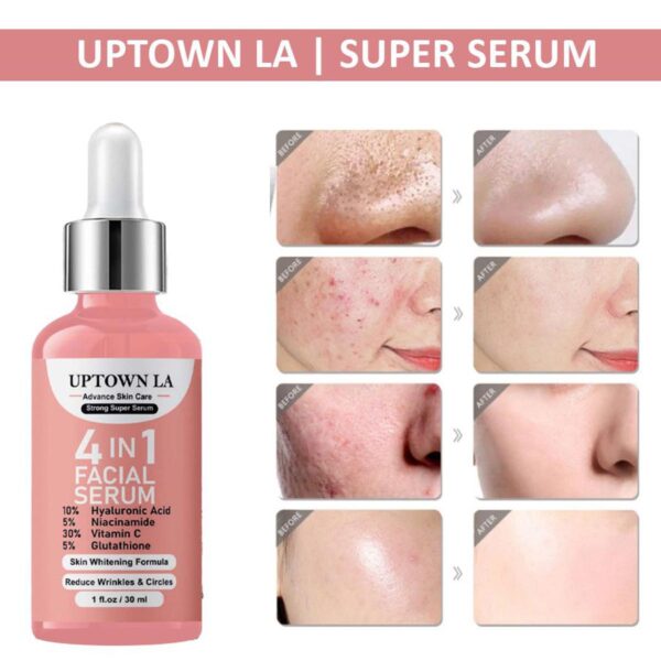 UPTOWN LA 4-in-1 Super Skin Glowing Serum – 5% Niacinamide, 30% Vitamin C, Vitamin E & Hyaluronic Acid – 30ml